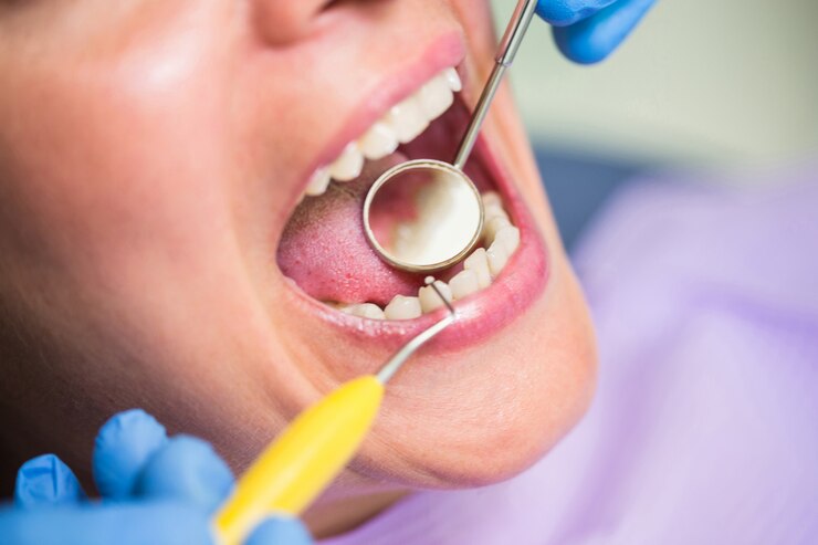 Missing Teeth and Gum Disease Can Dental Implants Still Be an Option 