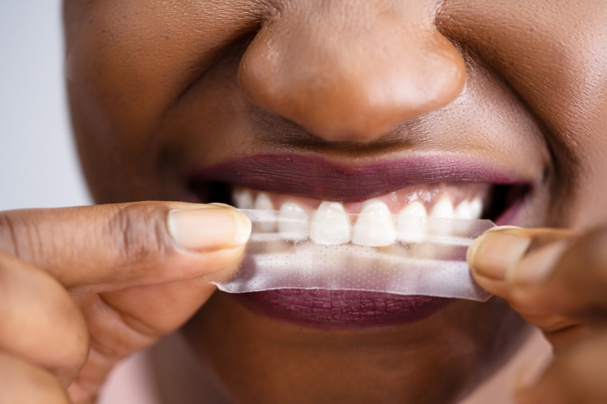 should you brush your teeth after using whitening strips