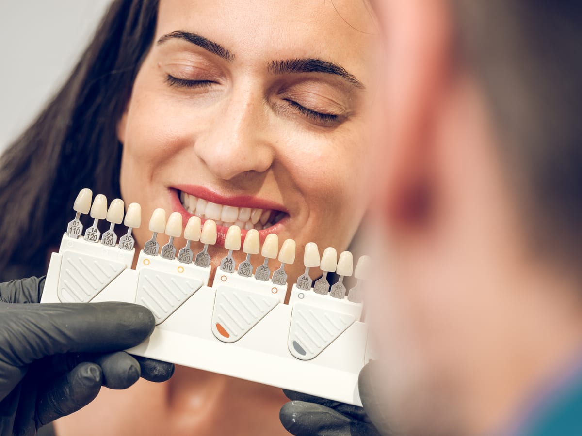 Veneers in Houston